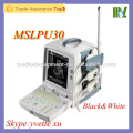 Best price doppler ultrasound machine Black and White ultrasound machine with CE & ISO approved